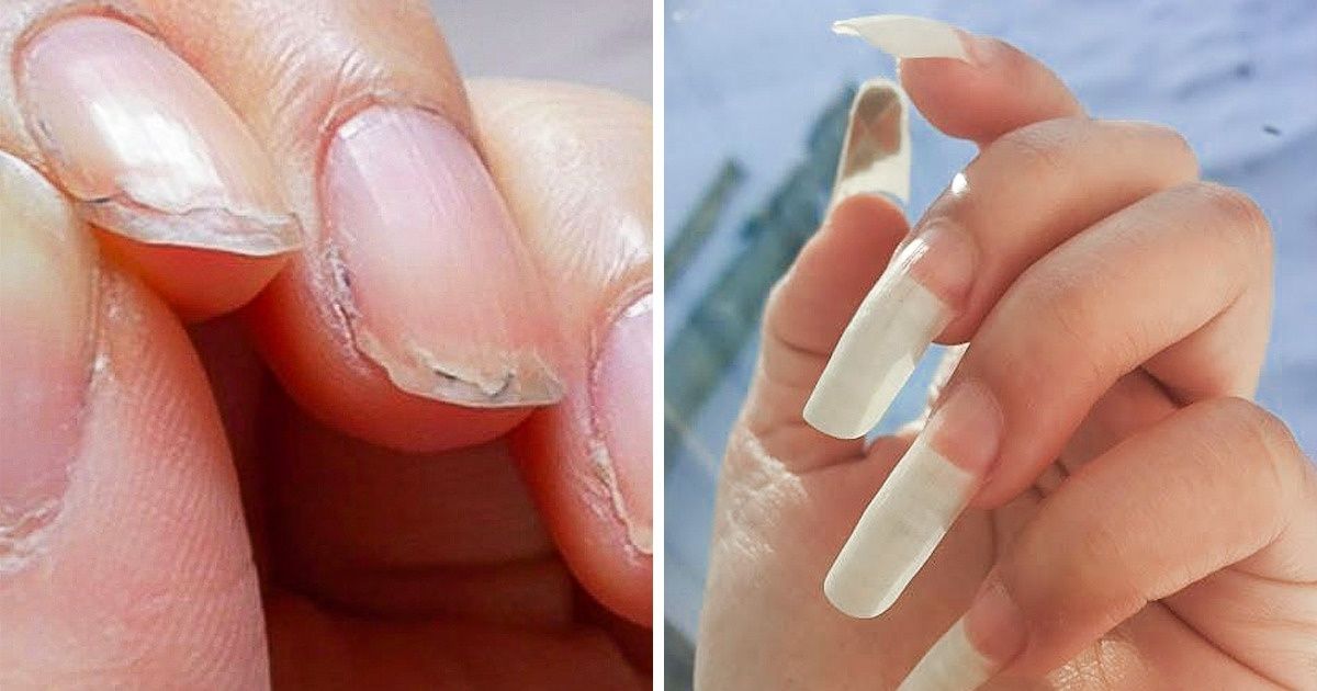 10 Formas naturales de restaurar tus uñas frágiles y débiles Genial