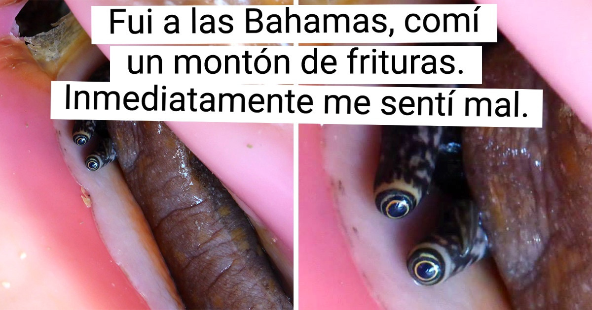 19 Personas que se llevaron una sorpresa durante sus vacaciones que jamás olvidarán