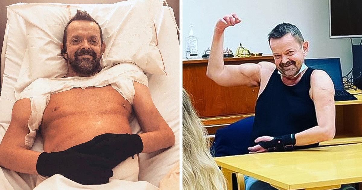 Un hombre cuyos brazos y hombros fueron amputados puede volver a dar abrazos Un hombre cuyos brazos y hombros fueron amputados puede volver a dar abrazos