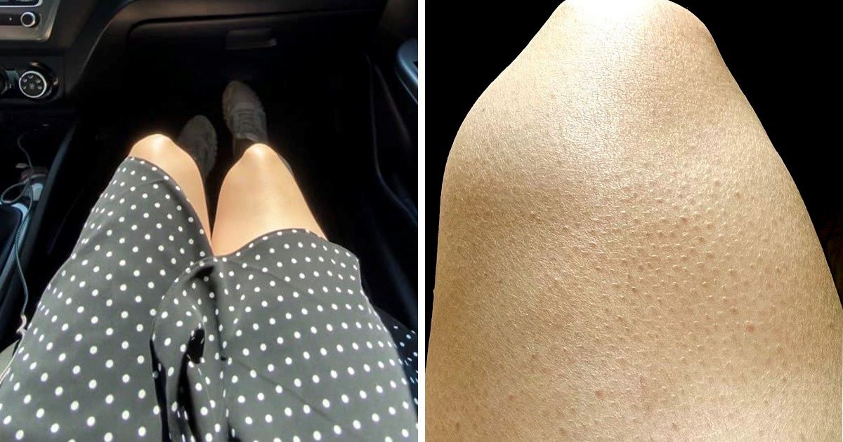 9 Peculiaridades de la apariencia que muchas mujeres consideran defectos, y no deberían