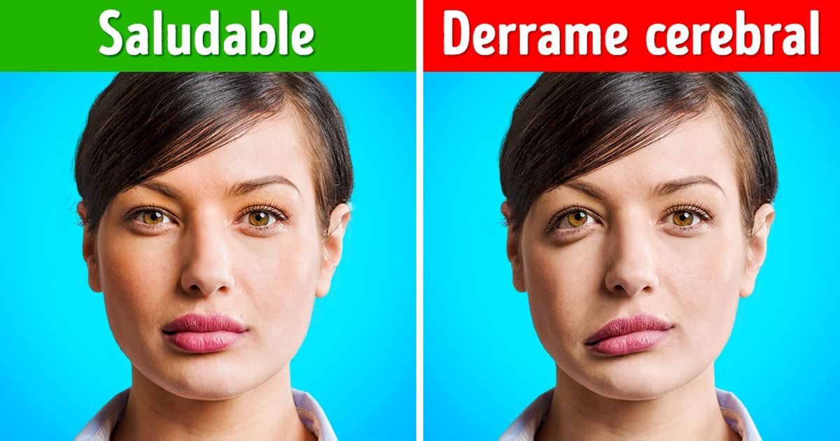 Conocer la diferencia entre estas 3 enfermedades del corazón puede salvarte la vida