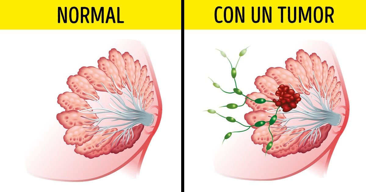 ¿Con qué frecuencia necesitas visitar a un médico para detectar una enfermedad en sus primeras etapas?