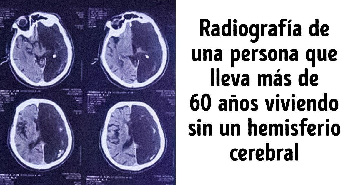 20 Hechos incomprensibles que podrían cambiar la idea que tienes sobre tu propio cuerpo 20 Hechos incomprensibles que podrían cambiar la idea que tienes sobre tu propio cuerpo