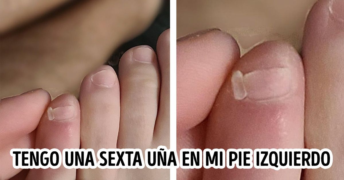 14 Personas que han recibido un regalo extra de la madre naturaleza