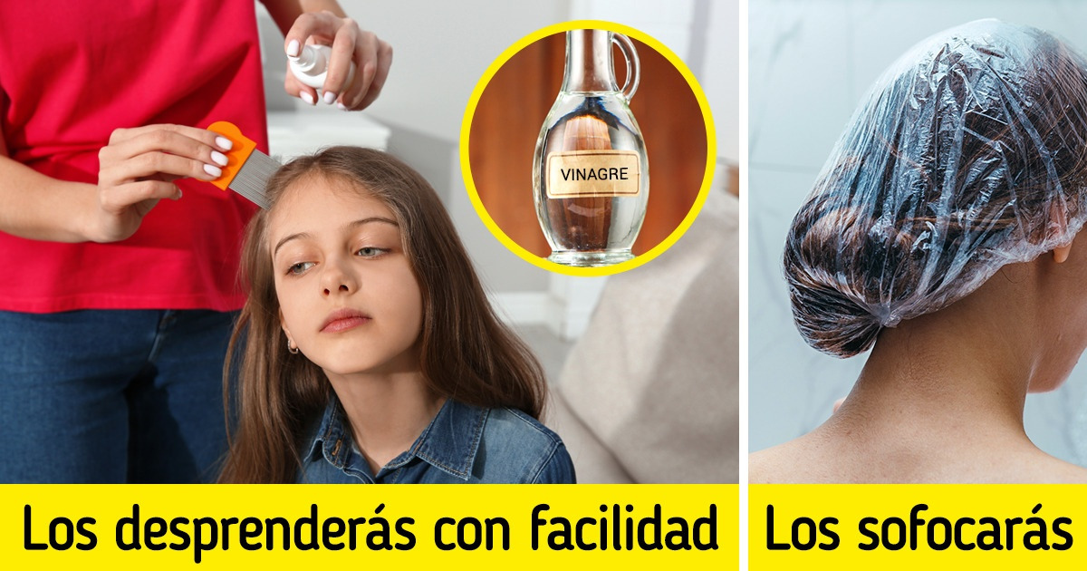 10 Consejos avalados por profesionales que podrían resultarte útiles para erradicar a los piojos 10 Consejos avalados por profesionales que podrían resultarte útiles para erradicar a los piojos