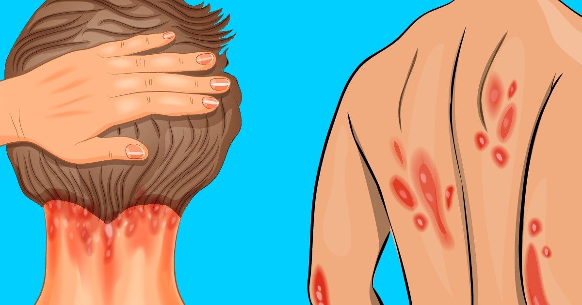¿Qué le pasa a tu cuerpo si no tomas suficiente sol?