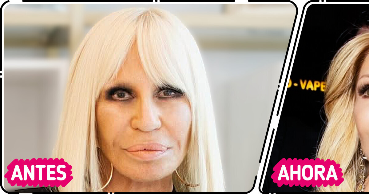 “¡Ese cirujano se merece un premio Nobel!”, el nuevo look de Donatella Versace causa revuelo en Internet “¡Ese cirujano se merece un premio Nobel!”, el nuevo look de Donatella Versace causa revuelo en Internet