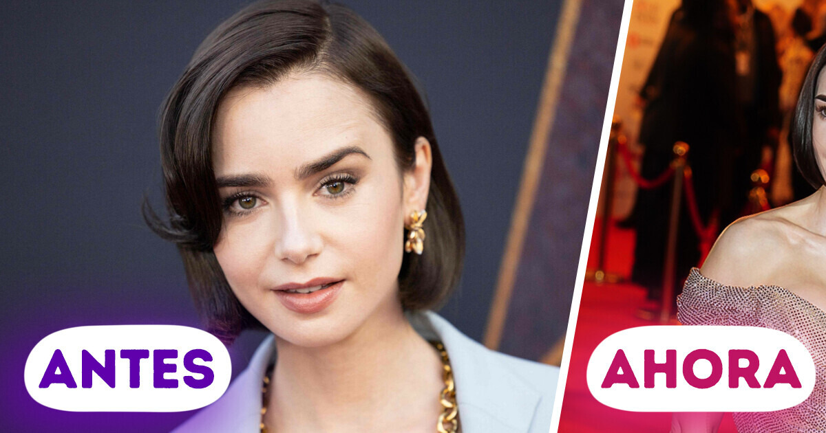 “¿Por qué esos implantes se ven tan mal?”, Lily Collins sorprende a internet con su última aparición “¿Por qué esos implantes se ven tan mal?”, Lily Collins sorprende a internet con su última aparición