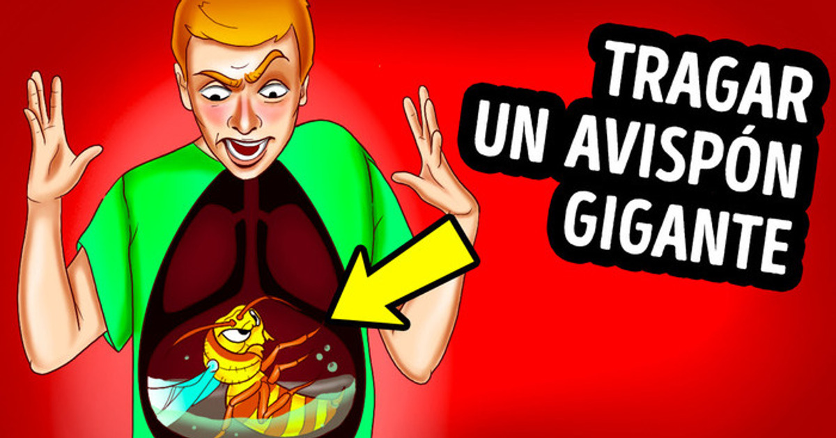 ¿Qué pasa si te tragas un avispón y te pica?