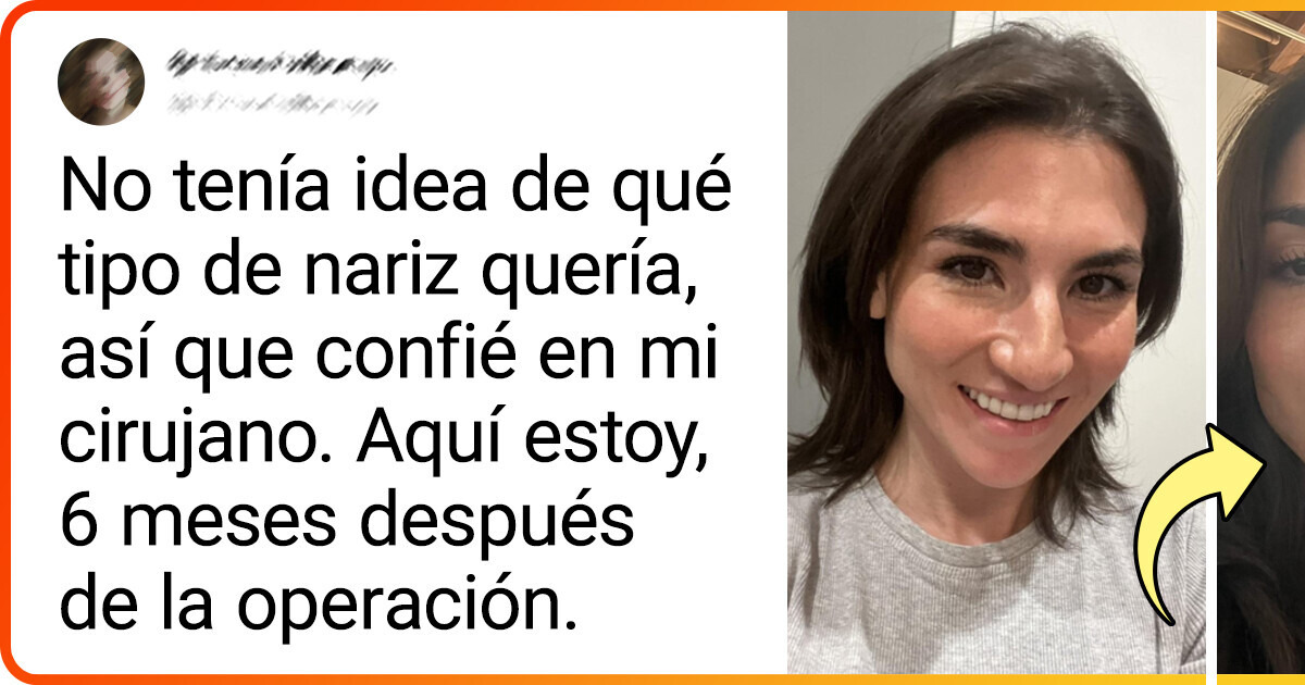 16 Comparaciones fotográficas que revelan impactantes transformaciones