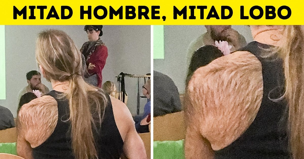 19 Usuarios de la red muestran con orgullo las cualidades únicas que les regaló la genética 19 Usuarios de la red muestran con orgullo las cualidades únicas que les regaló la genética