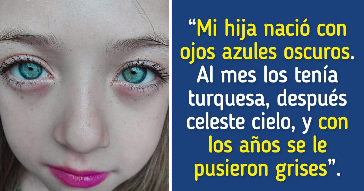 20 Usuarios de Genial mostraron sus rasgos únicos, y parece que la naturaleza les hizo un buen regalo