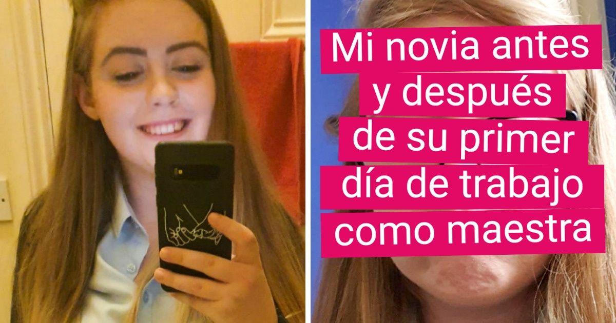 18 Comparaciones de la vida real que muestran gráficamente una diferencia asombrosa