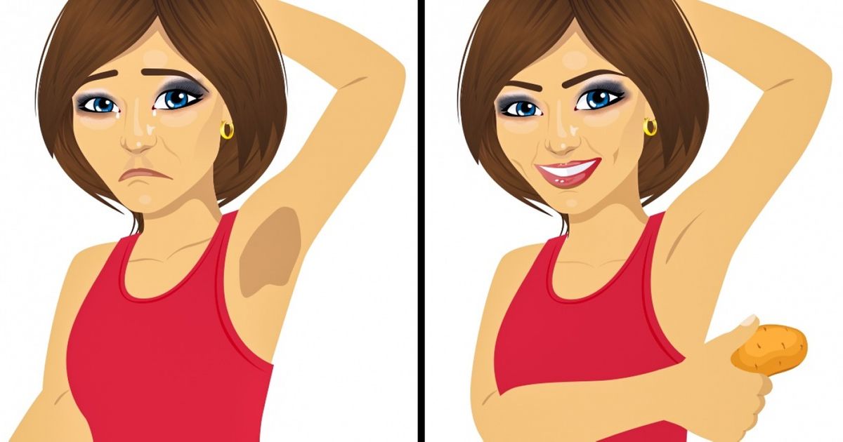 11 Alimentos que pueden ayudar a tu piel a lucir mucho mejor 11 Alimentos que pueden ayudar a tu piel a lucir mucho mejor