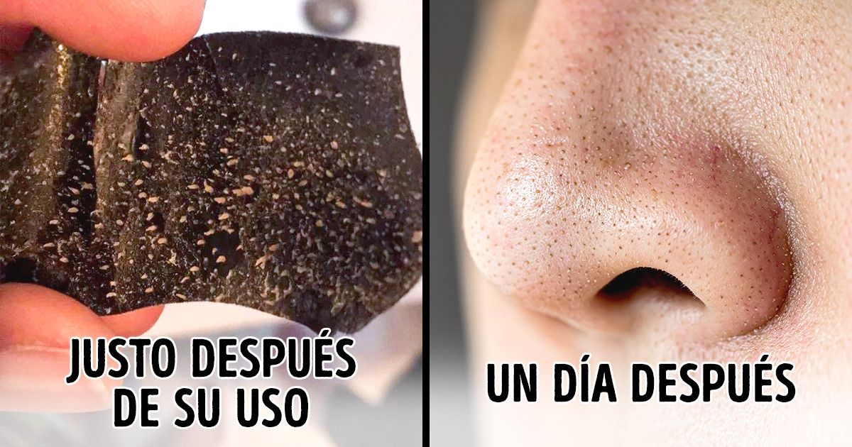 6 Cosas que debes saber antes de usar las tiras limpiadoras de poros 6 Cosas que debes saber antes de usar las tiras limpiadoras de poros