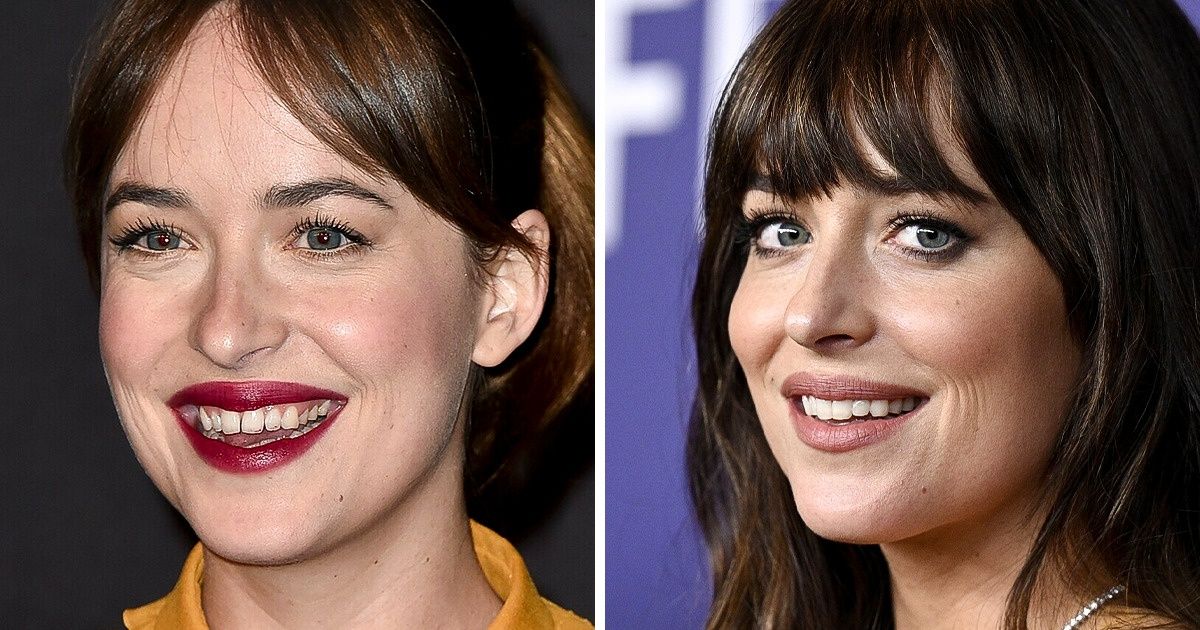 15 Famosos que arreglaron sus dientes y ahora deslumbran con su sonrisa incluso a los paparazis más insidiosos 15 Famosos que arreglaron sus dientes y ahora deslumbran con su sonrisa incluso a los paparazis más insidiosos