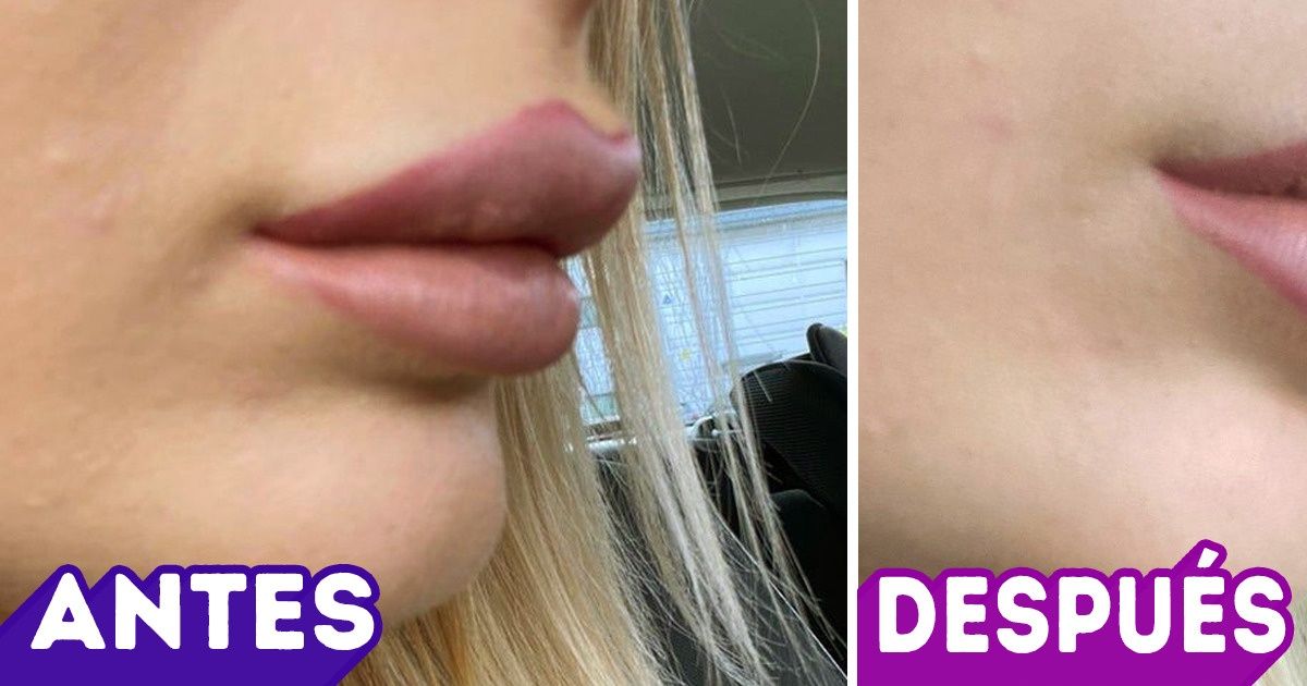 18 Chicas que siguieron la moda y trataron de mejorarse a sí mismas, pero luego cambiaron de opinión