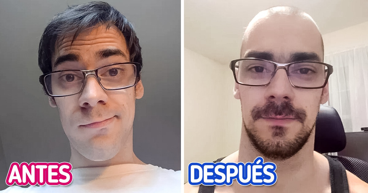17 Usuarios que no tuvieron miedo de afeitar su cabeza y ahora lucen aún mejor
