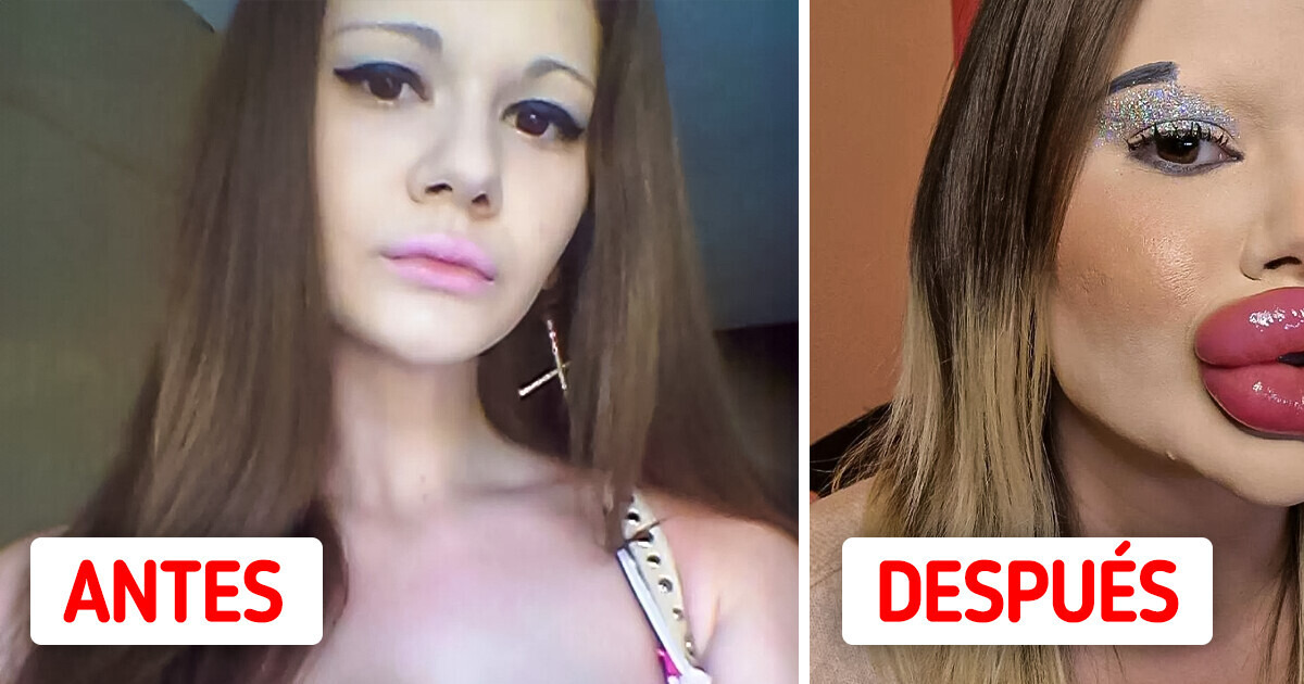 Conoce a la mujer que tiene los labios más grandes del mundo y quiere hacerlos aún más voluminosos Conoce a la mujer que tiene los labios más grandes del mundo y quiere hacerlos aún más voluminosos