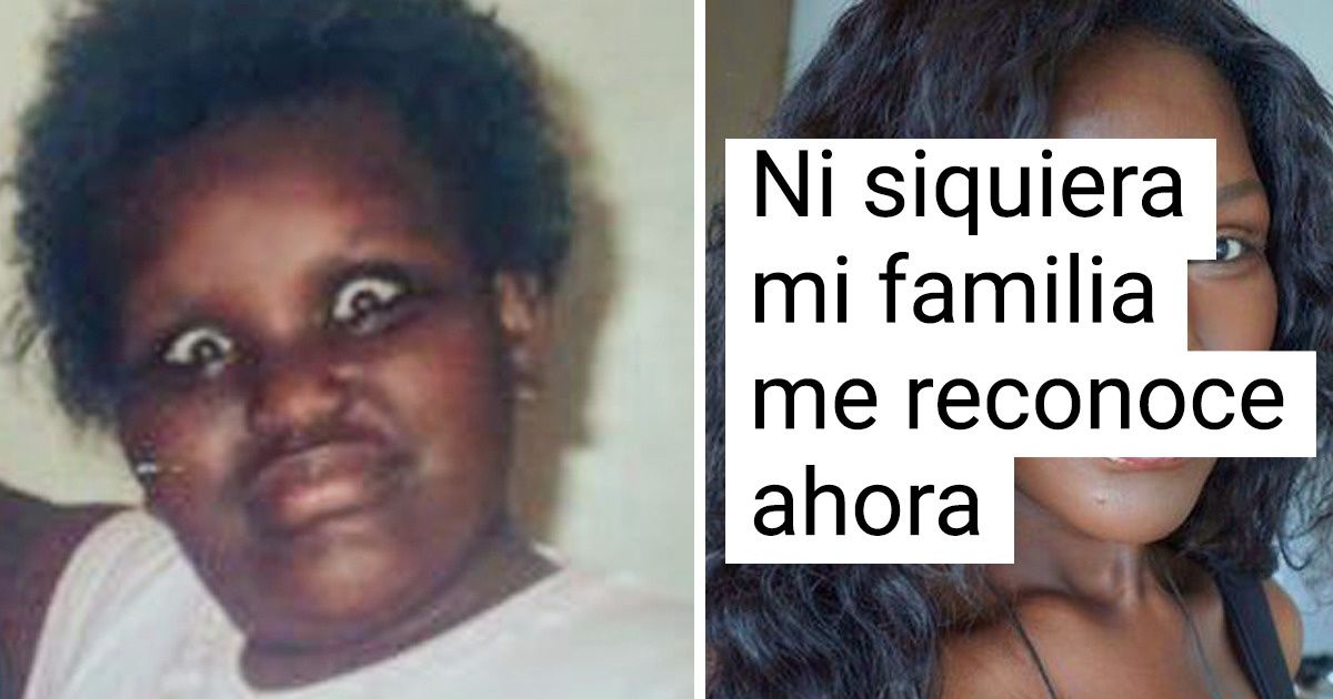 20 Personas que no estaban contentas con su apariencia, pero el destino les estaba preparando un verdadero premio gordo 20 Personas que no estaban contentas con su apariencia, pero el destino les estaba preparando un verdadero premio gordo