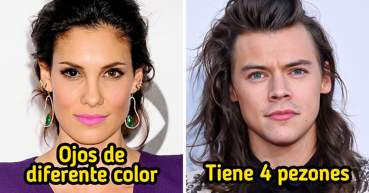 10 Famosos con características especiales que realmente los hacen únicos 10 Famosos con características especiales que realmente los hacen únicos