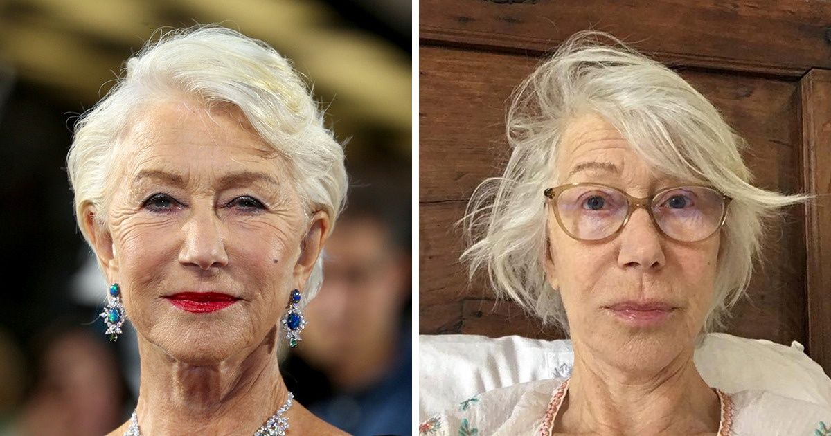 13 Veces en las que los famosos fueron 100 % libres de filtros de belleza