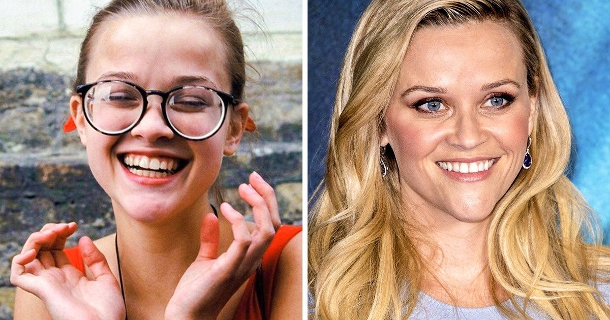 14 Celebridades que solían ser ñoños de jóvenes