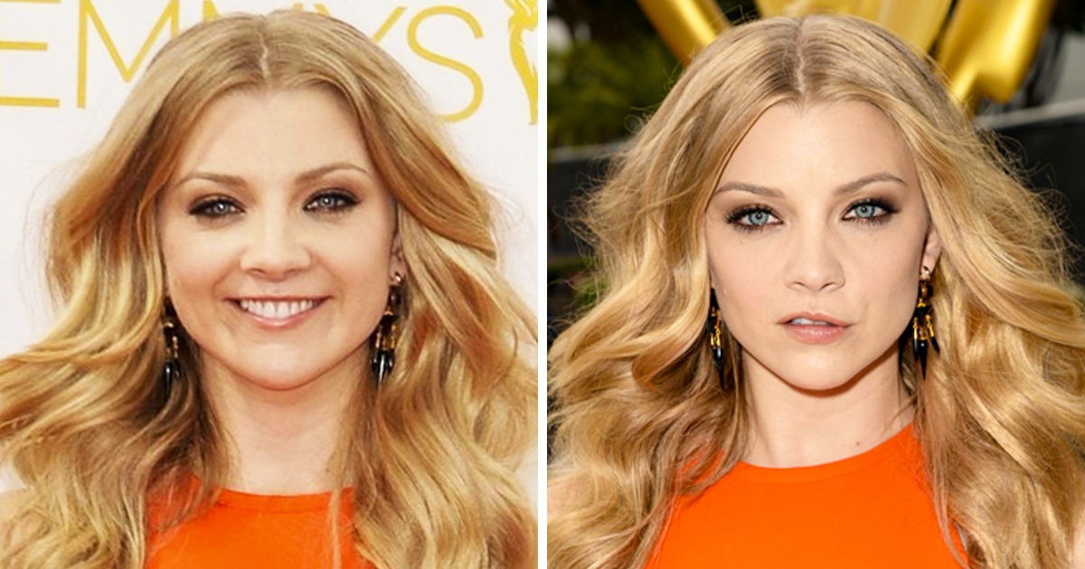 13 Celebridades que no se avergüenzan de algunas particularidades de su apariencia 13 Celebridades que no se avergüenzan de algunas particularidades de su apariencia