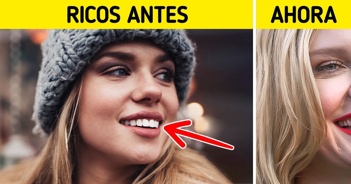 14 Procedimientos de belleza que ayer eran muy populares, pero de los cuales hoy todos huyen 14 Procedimientos de belleza que ayer eran muy populares, pero de los cuales hoy todos huyen