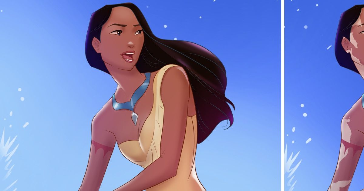 Así se verían 15 princesas de Disney si tuviesen vitíligo Así se verían 15 princesas de Disney si tuviesen vitíligo