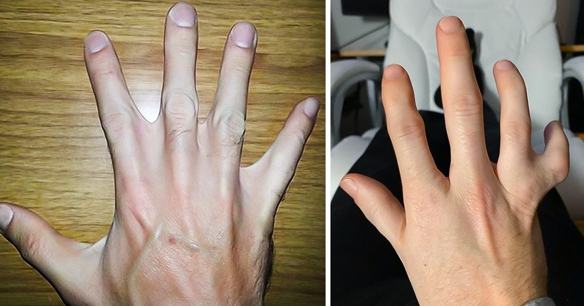 16 Personas que llevan una pequeña bendición de la naturaleza en su cuerpo
