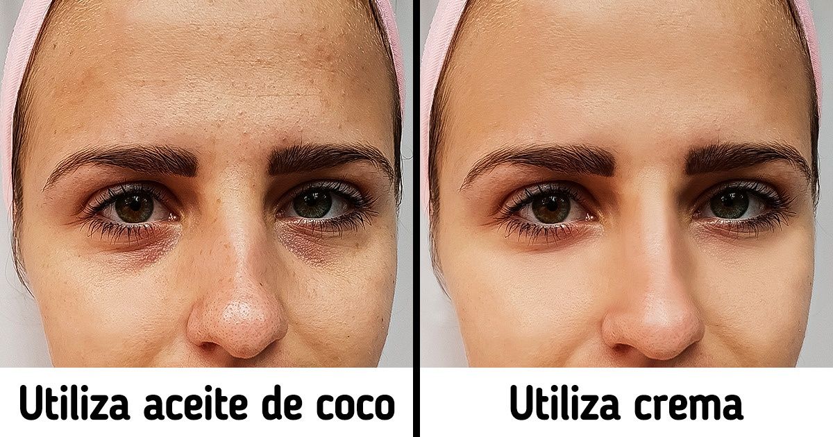 8 Procedimientos de belleza que probablemente sea mejor evitar 8 Procedimientos de belleza que probablemente sea mejor evitar