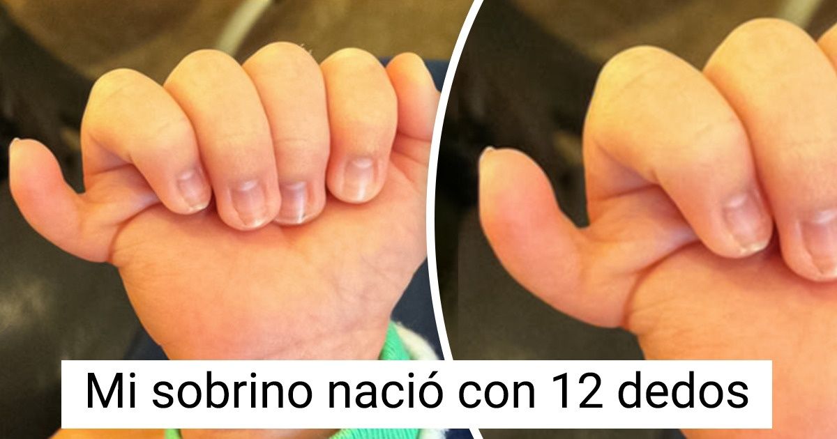 12 Personas que hacen del mundo un lugar único con su singularidad 12 Personas que hacen del mundo un lugar único con su singularidad