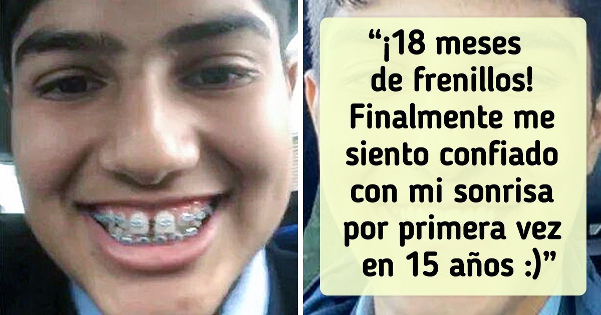 20 Usuarios mostraron cómo cambió su apariencia corrigiendo un detalle (nuevas fotos)