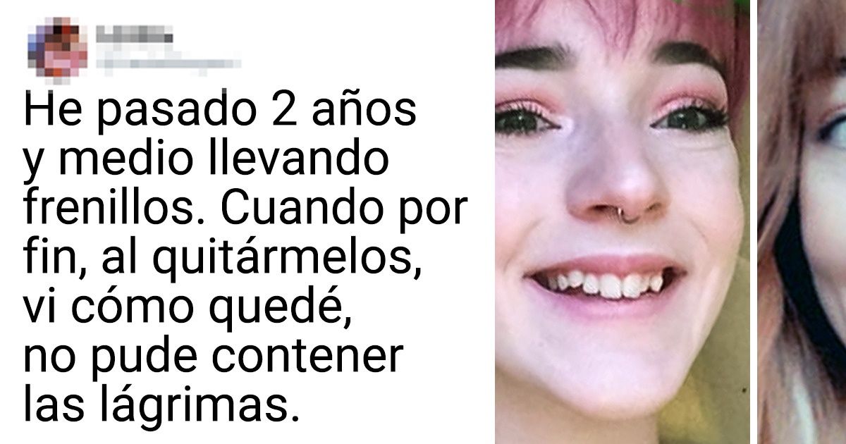 19 Fotos que manifiestan de manera excelente lo que es el progreso