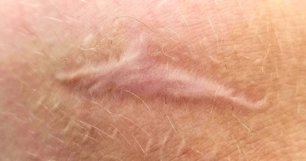 20+ Fenómenos asombrosos que sucedieron por casualidad