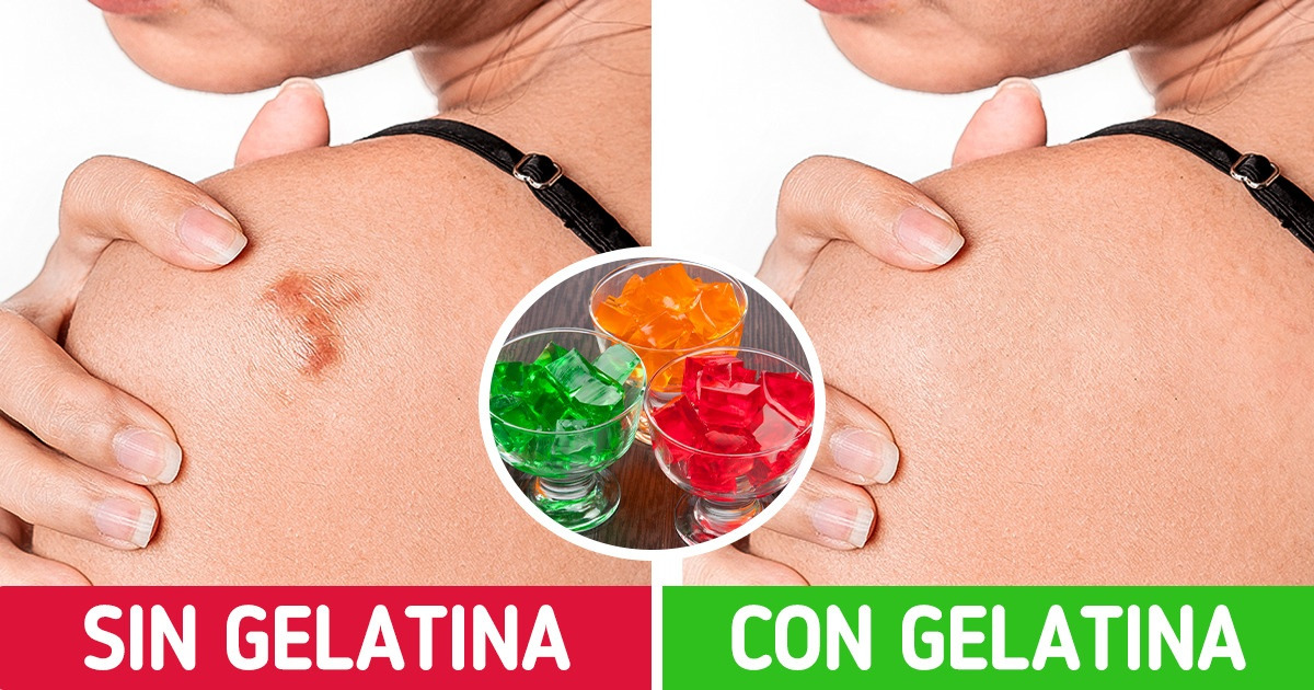 9 Beneficios que obtenemos de la gelatina al consumirla con regularidad