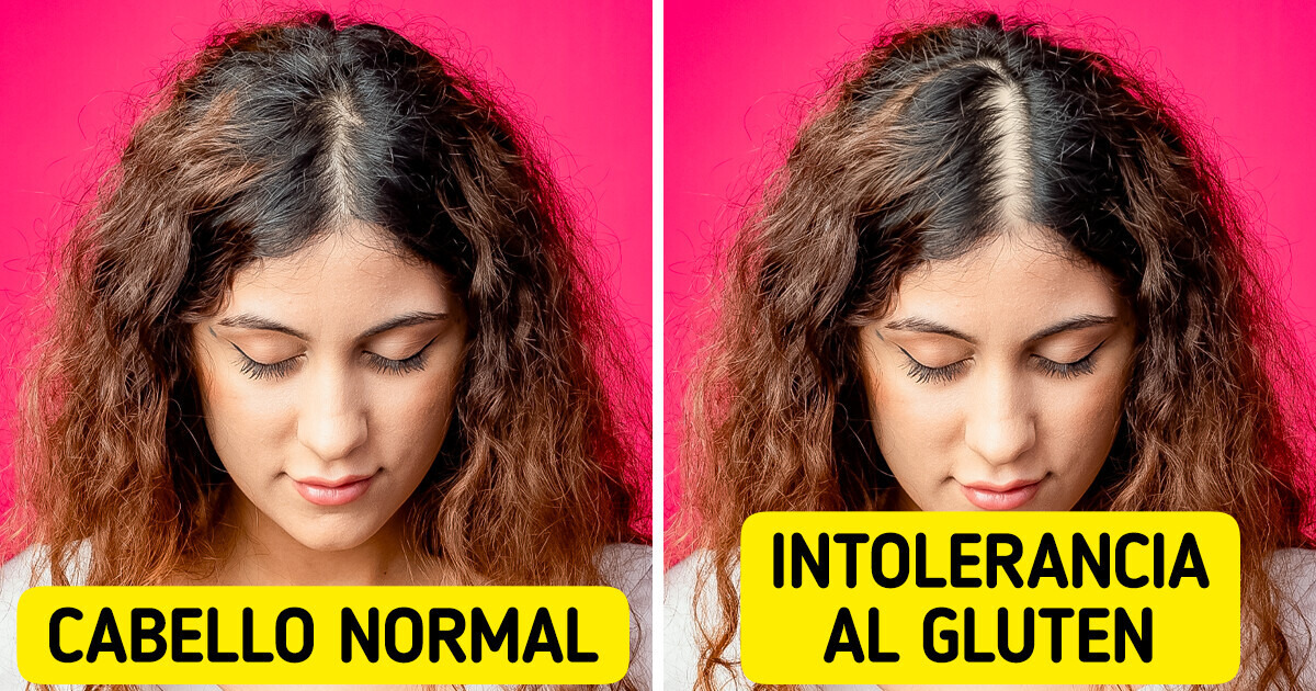 13 Maneras inesperadas en las que el gluten puede impactar tu cuerpo 13 Maneras inesperadas en las que el gluten puede impactar tu cuerpo