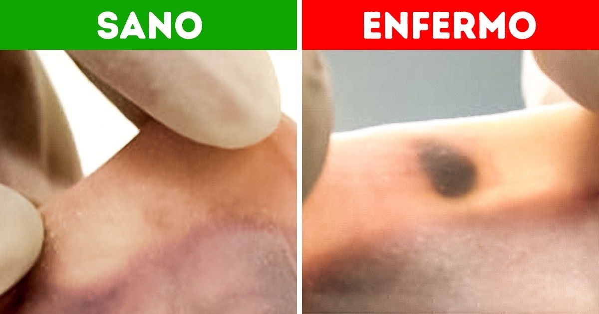 En Suiza descubrieron cómo detectar enfermedades peligrosas en sus primeras etapas