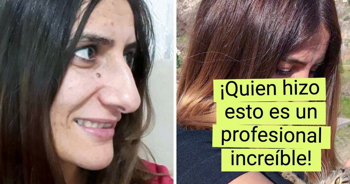 20+ Chicas audaces que se dijeron a sí mismas “¡Basta de aguantar esto!” y recurrieron a la cirugía plástica 20+ Chicas audaces que se dijeron a sí mismas “¡Basta de aguantar esto!” y recurrieron a la cirugía plástica