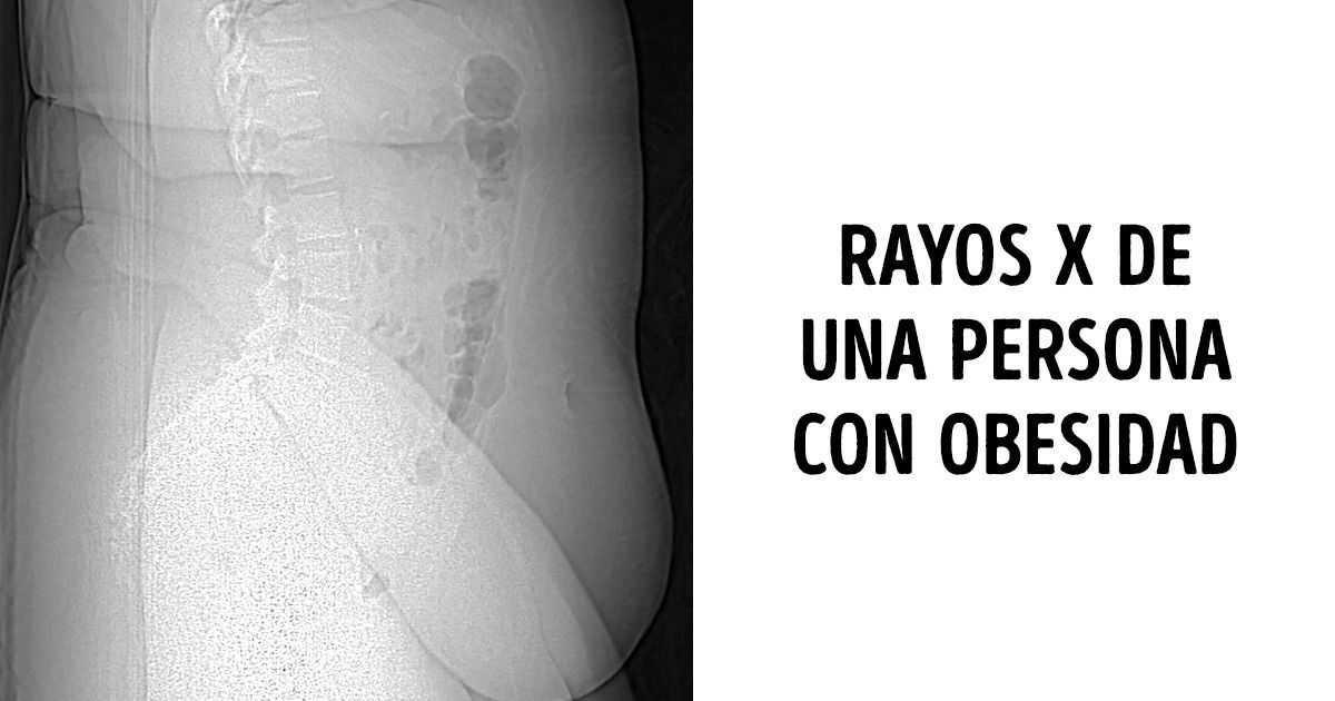 16 Imágenes del cuerpo humano que no se pueden tomar con una cámara normal