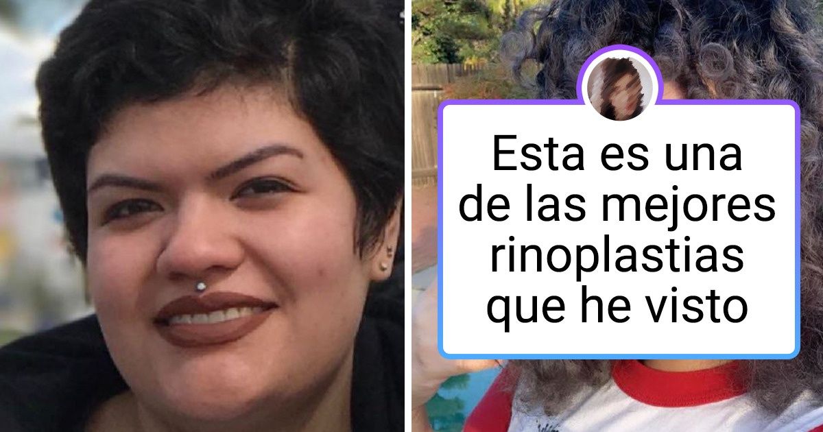 16 Personas que no tuvieron miedo de someterse a una cirugía plástica y terminaron con un aspecto completamente nuevo