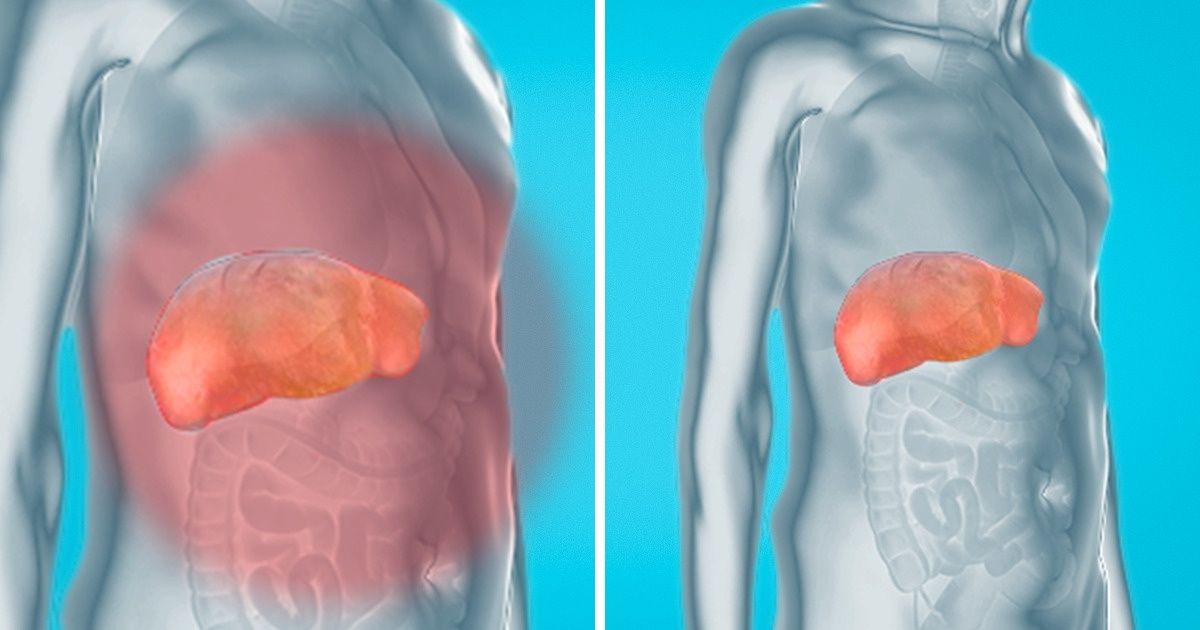 Cómo eliminar las toxinas de tu hígado, riñones y vejiga de forma natural y delicada