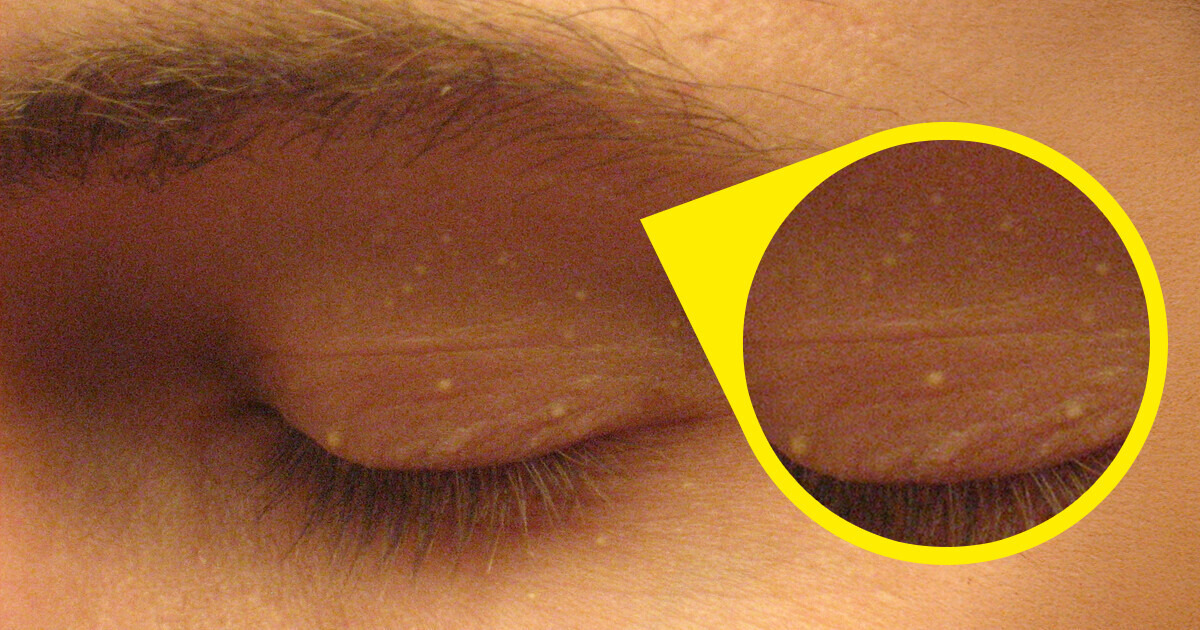 4 Cambios sutiles en tu rostro que podrían alertarte sobre problemas de salud 4 Cambios sutiles en tu rostro que podrían alertarte sobre problemas de salud