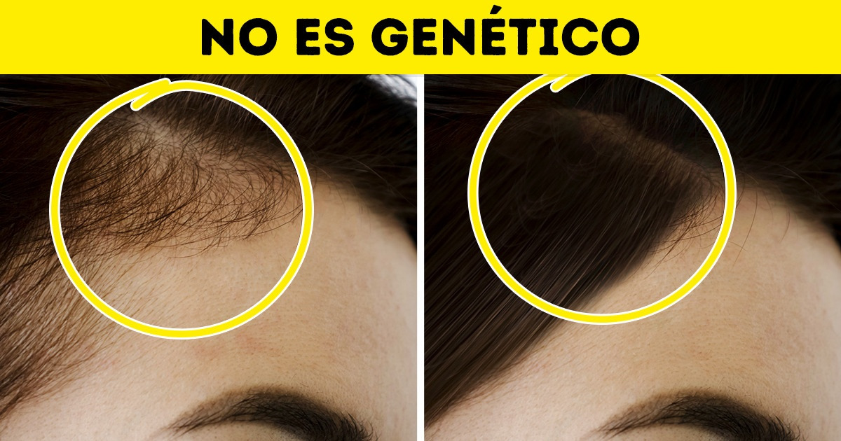 10 Grandes mentiras sobre rutinas de belleza que muchas personas han creído durante décadas 10 Grandes mentiras sobre rutinas de belleza que muchas personas han creído durante décadas