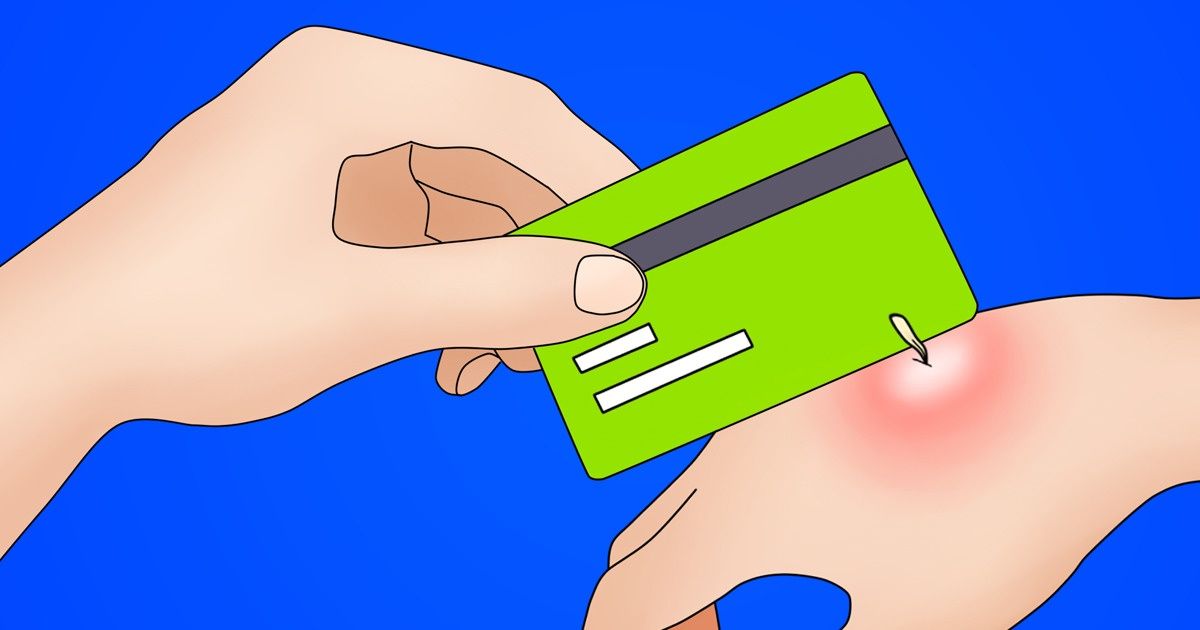 10 Usos inesperados de artículos cotidianos que un día podrían salvarte la vida (Spoiler: los condones resultan ser aún más útiles de lo que pensábamos) 10 Usos inesperados de artículos cotidianos que un día podrían salvarte la vida (Spoiler: los condones resultan ser aún más útiles de lo que pensábamos)