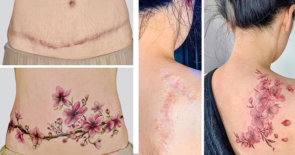 Tatuadora vietnamita usa su toque mágico para ayudar a las personas a recuperar la confianza en sí mismas cubriendo sus cicatrices con arte Tatuadora vietnamita usa su toque mágico para ayudar a las personas a recuperar la confianza en sí mismas cubriendo sus cicatrices con arte