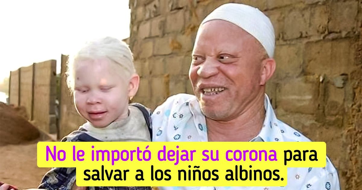 Cantante africano que fue marginado por ser albino pasó de tocar en las calles a ser famoso y hoy ayuda a gente con su condición Cantante africano que fue marginado por ser albino pasó de tocar en las calles a ser famoso y hoy ayuda a gente con su condición