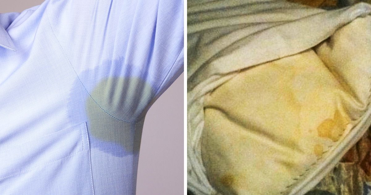 15 Maneras fáciles de eliminar las manchas molestas para siempre