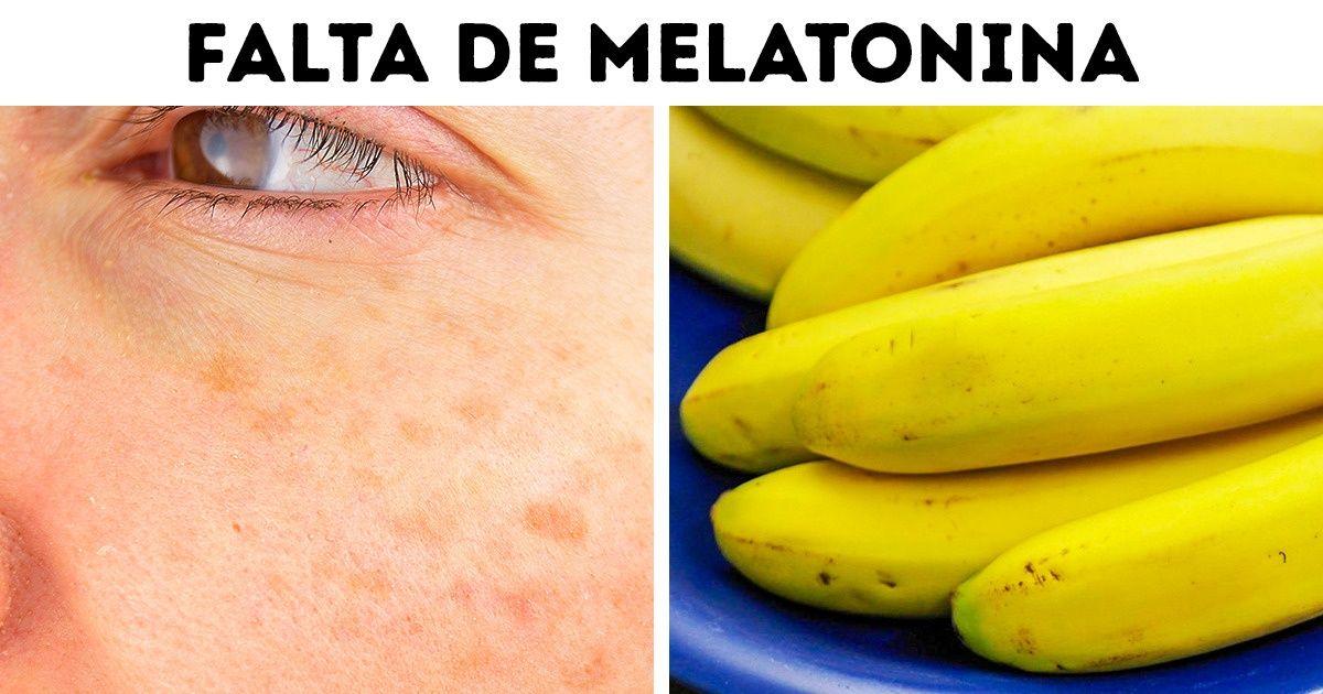 6 Hormonas por las cuales las mujeres envejecen rápido 6 Hormonas por las cuales las mujeres envejecen rápido